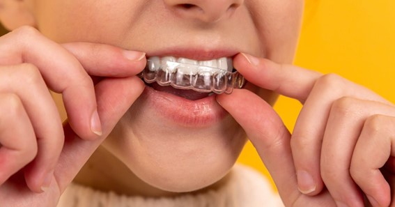 How To Know If Your Retainer Doesn’t Fit?